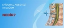 Doğumda Epidural Anestezi Nedir ve Nasıl Yapılır?