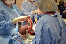 Epidural Sezeryan Neden Uygulanır?