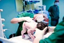 Epidural Sezeryan Riskleri Nelerdir?